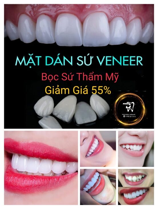 VIỆN NHA KHOA THẨM MỸ D-DENTAL CẦN THƠ