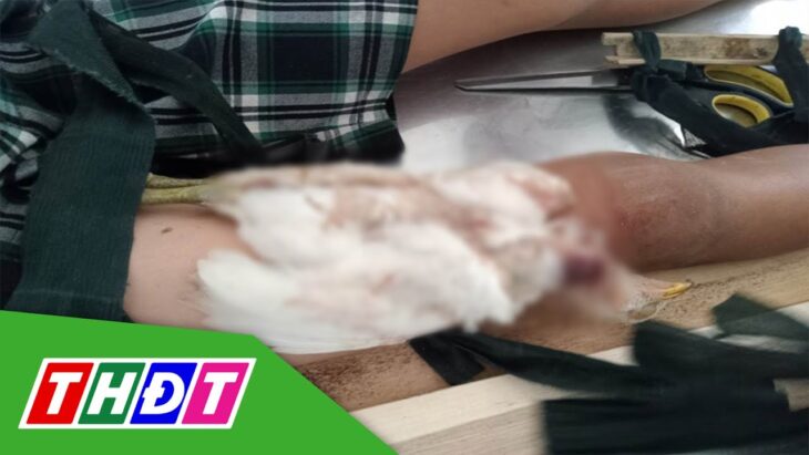 Quảng Ngãi: Bị nhiễm trùng vì bó con gà để chữa gãy xương đùi | THDT