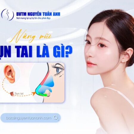 Giải đáp thắc mắc về nâng mũi sụn tai