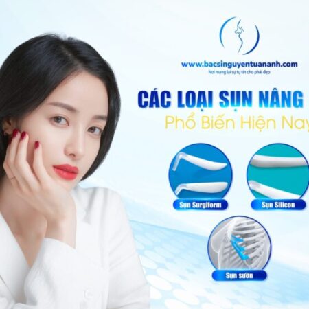 Các loại sụn nâng mũi phổ biến hiện nay