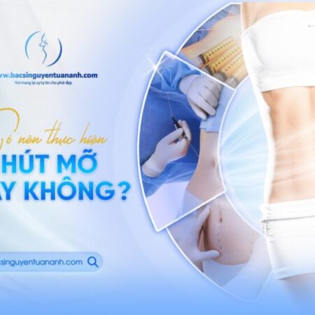 Những điều cần biết khi hút mỡ