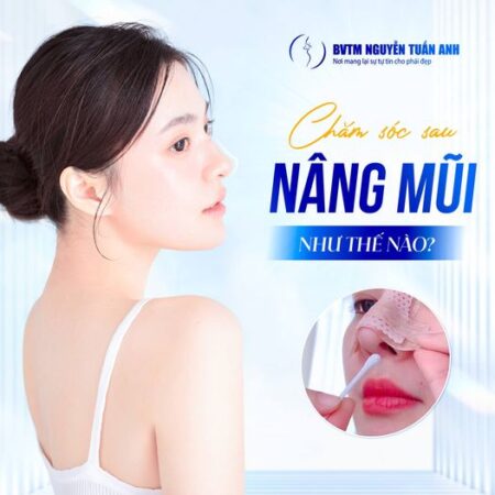 Chăm sóc sau nâng mũi như thế nào?