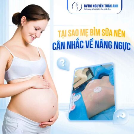 Những điều cần biết về nâng ngực cho mẹ bỉm sữa