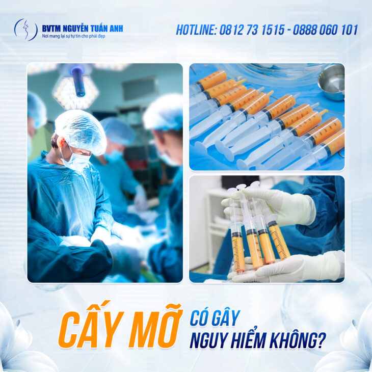 Cấy mỡ mặt có giúp trẻ hóa lâu dài không