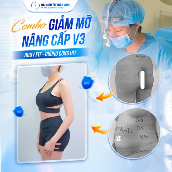 Combo giảm mỡ nâng cấp vòng 3