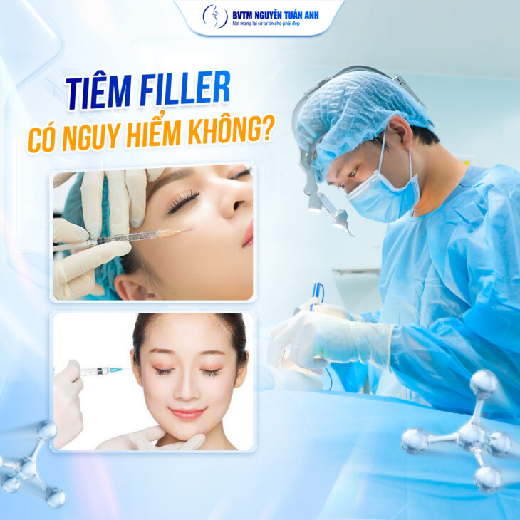 Tiêm Filler: An Toàn Hay Tiềm Ẩn Nguy Cơ