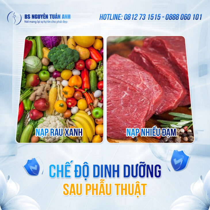 Phục hồi sau phẫu thuật thẩm mỹ
