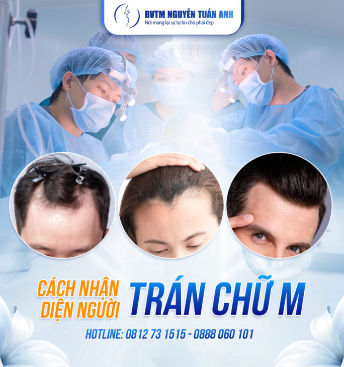 Cằm tròn đầy: Biểu tượng cuộc sống giàu sang viên mãn