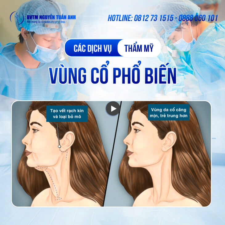 Các dịch vụ liên quan đến thẩm mỹ vùng cổ