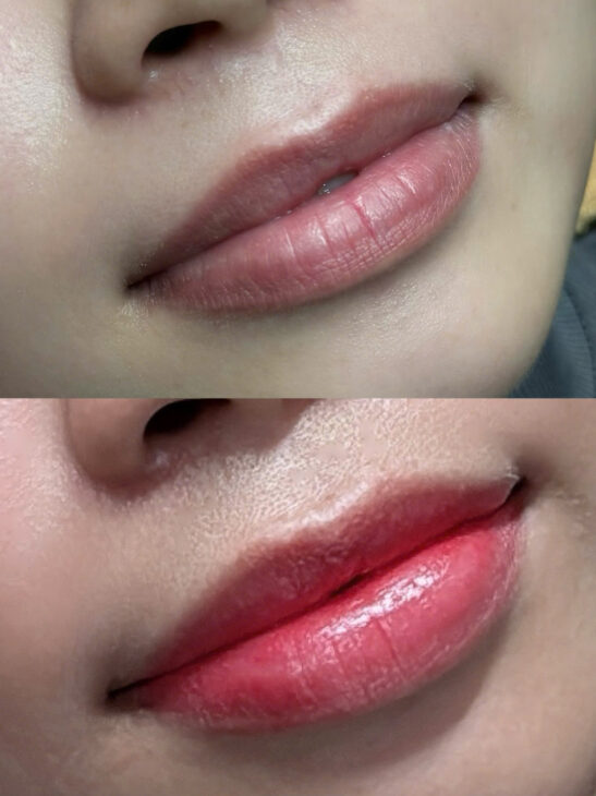 Combo xử lý thâm và phun môi Choushi – Giải pháp cho đôi môi tươi tắn, tự nhiên