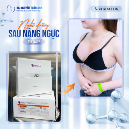 Nghỉ dưỡng sau nâng ngực bao lâu thì mới ổn định và vào form?