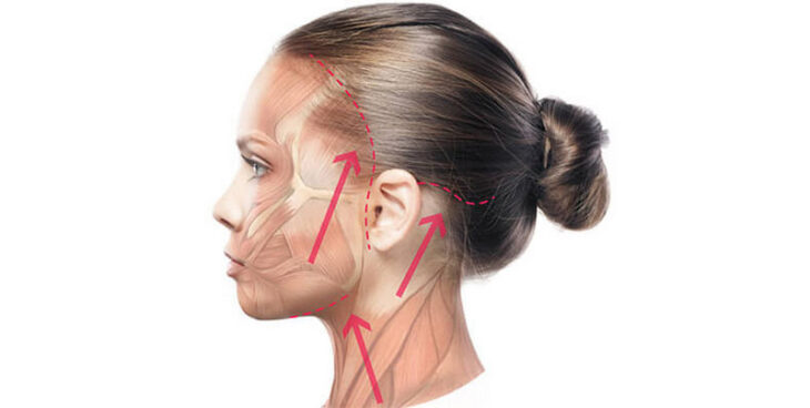Căng da mặt toàn phần có thật sự nguy hiểm không