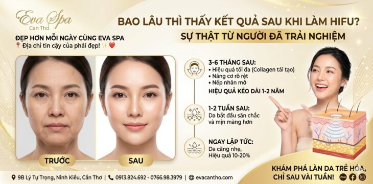 Bao lâu thì thấy kết quả sau khi làm HIFU? Eva Spa Cần Thơ Bao lâu thì thấy kết quả sau khi làm HIFU? Eva Spa Cần Thơ