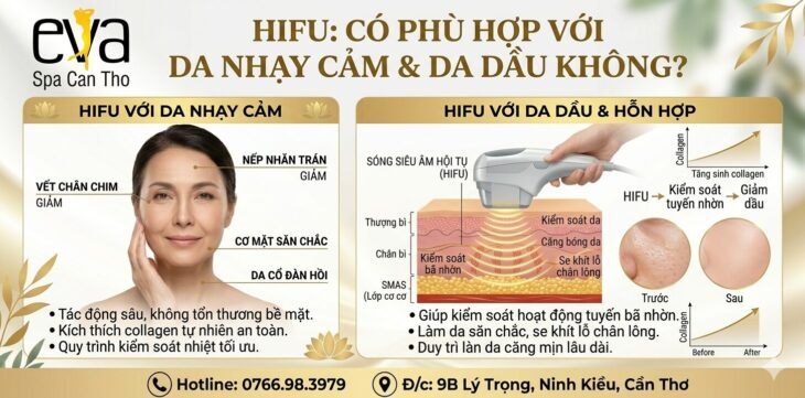 HIFU có phù hợp với da nhạy cảm và da dầu không? HIFU Eva Spa Cần Thơ