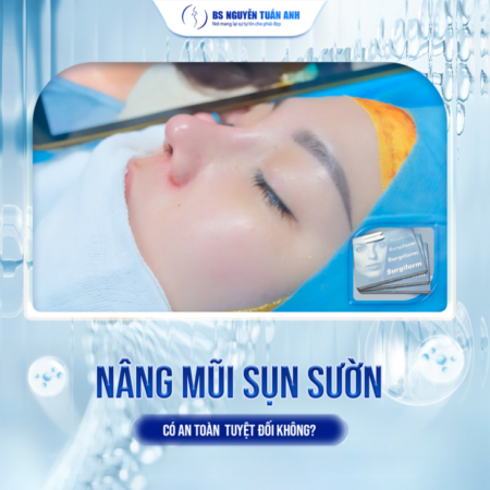 Sau nâng mũi sụn sườn nên ăn uống và sinh hoạt thế nào?